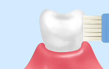 ブラッシング指導
